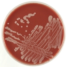 Bacteriekweek (bron: WBVR)