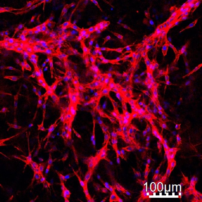 Nuclei, in blue, and actin, in red, of the  bone type cells growing inside the protein gels modified to improve cell adhesion. 