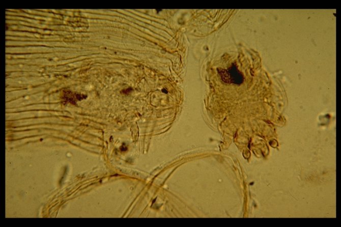 Microscopic image of tracheal mites (Acarapis woodi). The structure on the left is part of a tracheal tube of a honey bee.