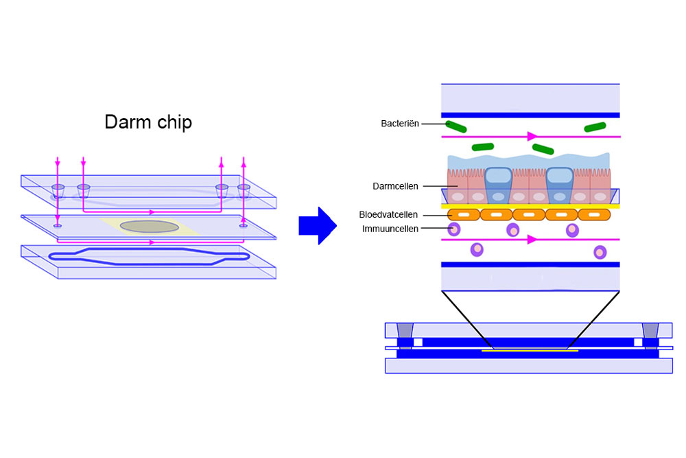 De darm op een chip bestaat uit enkele plaatjes met daartussen afweercellen, bloedvatcellen, darmcellen en bacteriën.
