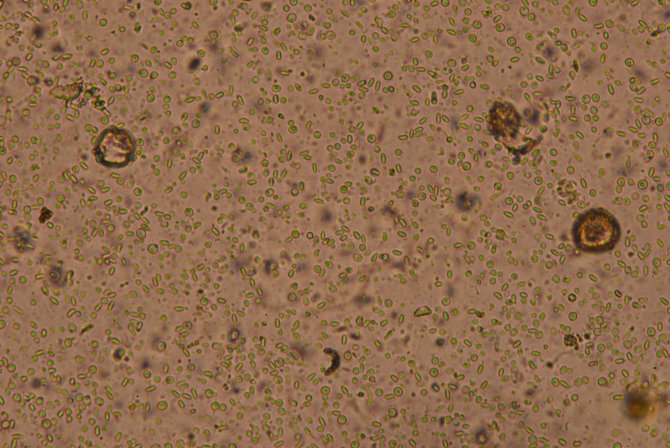 Nosema spp. in een monster genomen van het achterlijf van een honingbij bij een vergroting van 400x. De nosema-sporen zijn te herkennen als langwerpige cellen. Ze worden vaak vergeleken met rijstkorrels. De ronde cellen in dit preparaat zijn malpigh-amoeb