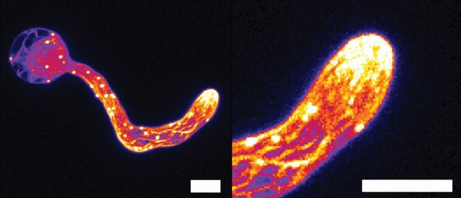 Microscopy recording of the cell skeleton of Phytophthora during penetration of a host shows the self-sharpening structure. Left: shot of the entire cell, right: close-up of the attack structure. Scale bar shows a distance of 5 micrometers