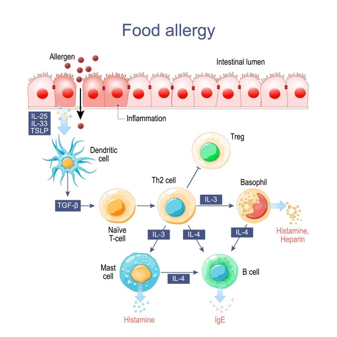 Figure Food Allergy